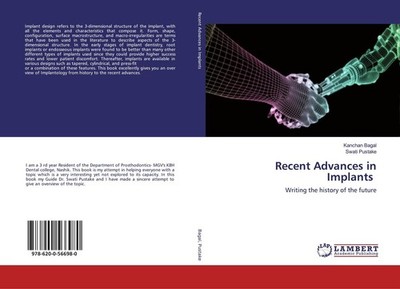 Recent Advances in Implants Kanchan Bagal