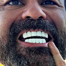 Real Solid 925 Sterling Silver White Enamel Grillz Top Bottom Teeth Grills Set