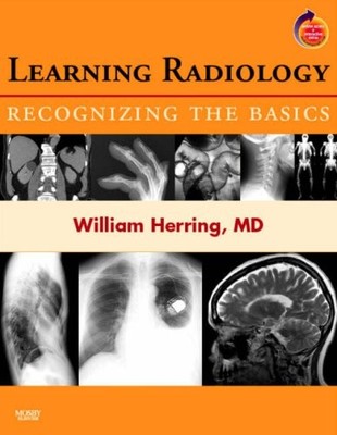 Learning Radiology: Recognizing the Basics (With STUDENT CONSULT Online Acce...