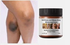 New Strong Whitening Cream For Removing Dark Knuckle Finger Elbow and Knee