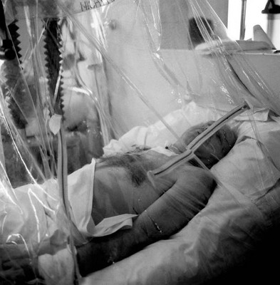 Matt Busby of Manchester United in an oxygen tent after Munich pla- 1958 Photo