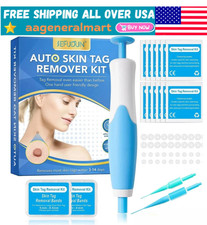 Auto Micro Skin Tag Remover Device Kit Safe Painless Removal 2-8 mm Band Tool