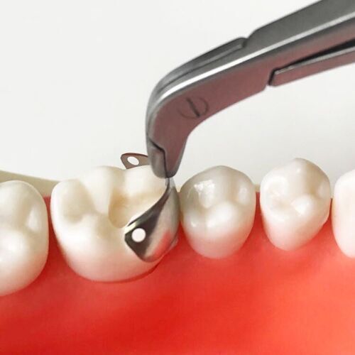 Dental Matrix Bands Ring Sectional Matrice Clamp Fit Garrison Palodent V3 System - Picture 10 of 124