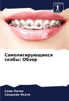 Saqm Patil (U. A.) | SamoligiruüSchiesq Skoby: Obzor | Taschenbuch | Russisch