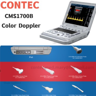 CONTEC CMS1700B Color Doppler Diagnostic Digital B-Ultrasound machine Scanner