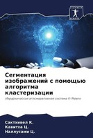 Sakthiwel K. (U. A.) | Segmentaciq Izobrazhenij S Pomosch'ü Algoritma...