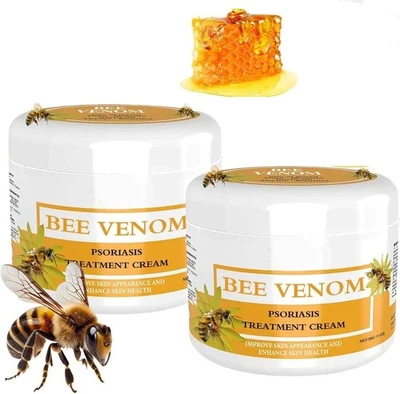 2PCS 30g Bee Venom Psoriasis Cream, Cvreoz Bee Venom Psoriasis Cream, New Zealan