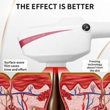 IPL OPT Elight Laser Permanent Hair Removal Skin Rejuvenation Salon Machine