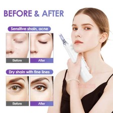NEW Electric Skins Water Machine Skin Care Wrinkle Remove Skins Rejuvenation Pen