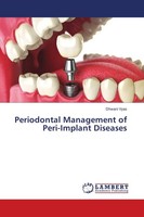Periodontal Management Of Peri-Implant Diseases Dhwani Vyas