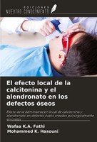 El Efecto Local De La Calcitonina Y El Alendronato En Los Defectos óSeos Buch