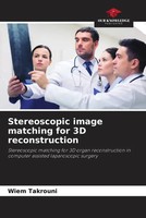 Stereoscopic Image Matching For 3D Reconstruction Wiem Takrouni (U. A.) Buch