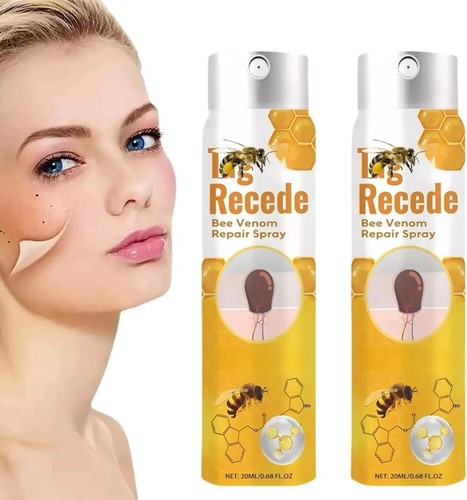 2Pcs Bee Venom Treatment Spray, 2024 New Professional Bee Venom Repair Cream, Pr