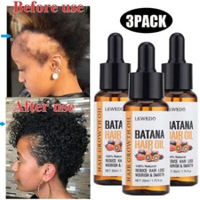 3Pcs Batana Oil Essence For Hair Growth Anti-Hair Loss Damaged Hair Root Repair