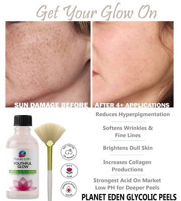 60% Glycolic Acid Skin Peel Kit + Glycolic Cleanser + Recovery Cream + BRUSH 