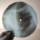 LED ZEPPELIN I CANT QUIT YOU BA X-Ray USSR Record Roentgen Bone Ribs Music Vinyl