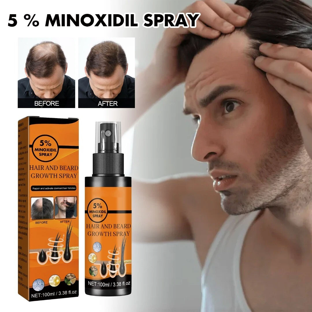Aggregate 133+ minoxidil hair growth camera.edu.vn