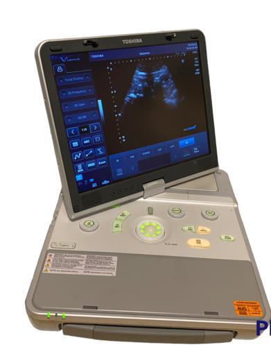 Toshiba Viamo Portable Ultrasound Machine 2013 - Picture 2 of 4