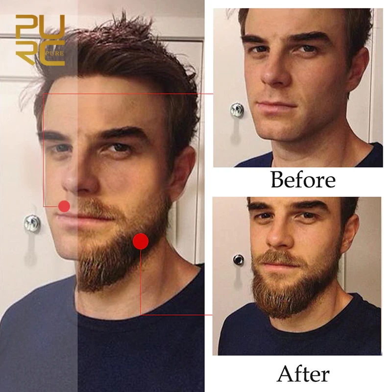 Beard Growth Oil Serum Fast Growing Beard Mustache Facial Hair Grooming for Men - Image 3 of 4