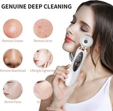 2025 Blackhead Remover Pore Vacuum, Visual Rechargeable Blackhead Vacuum Faci...