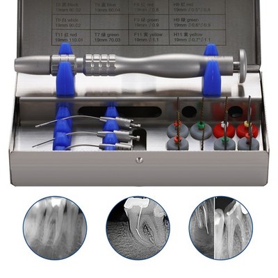 Dental Endo Removal System Kit Broken Root Canal Files Extraktor Tools Feilen