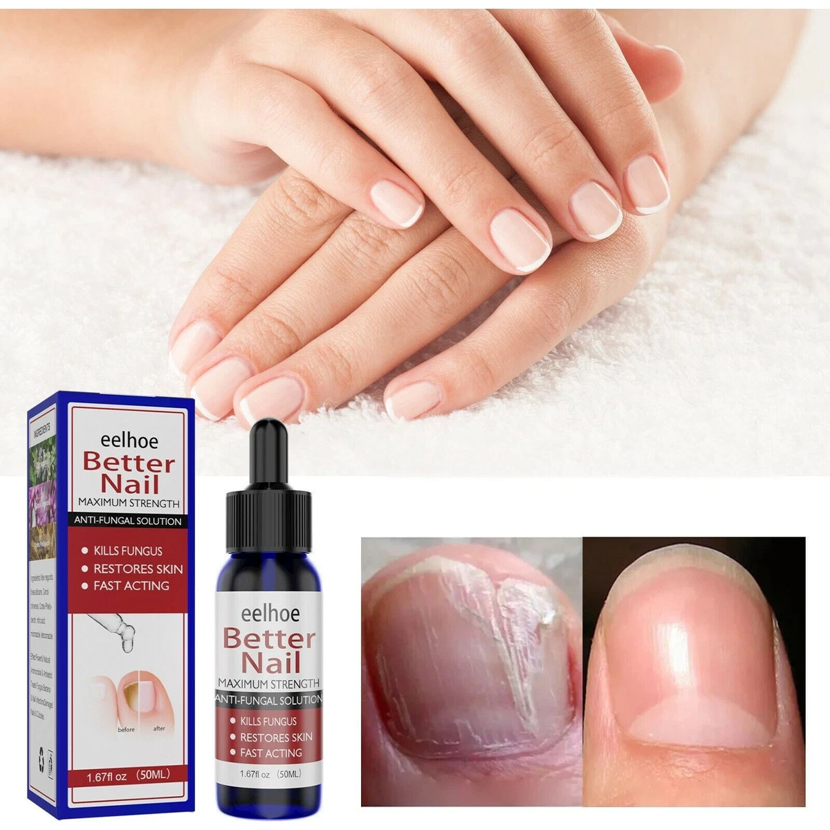 Why You Shouldn't Use Bleach for Toenail Fungus