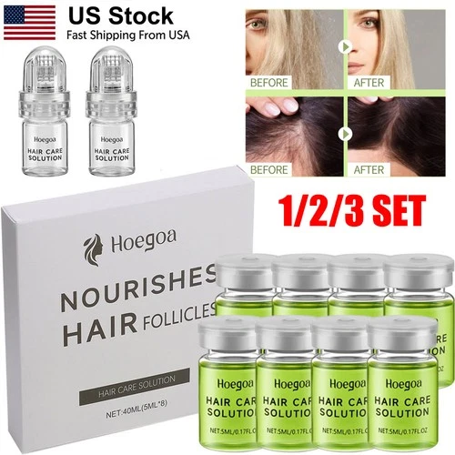 Microneedle Infusion Hair Regrowth System, Advanced Hair Growth Treatment, USA