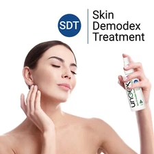 Skin Demodex Treatment for Acne Rosacea, Seborrheic Dermatitis, Demodicosis Rash