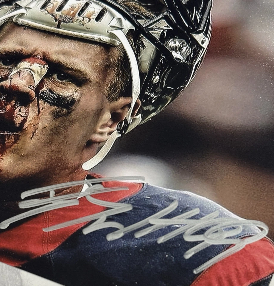 J.J Watt Nariz Sangrienta Autografiado Firmado 8x10 Reproductor de Imágenes Certificado Auténtico Foto 2 de 3