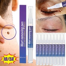1-10X Skin Tag Remover Pen Skin Tag Mole Wart...