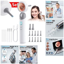 Family-Friendly 1080P HD Otoscope with 1.38" Screen - Safe  Easy Health Checks