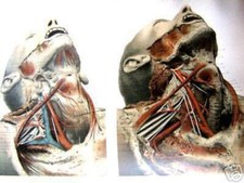 Anatomy Disease Forensic Specimen Medical Surgery Autopsy Medicine Freak Bizarre
