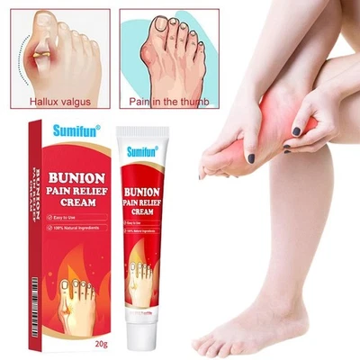 Foot Arching Bunion Pain Relief Ointment Toe Valgus Corrector Cream Hallux 20g