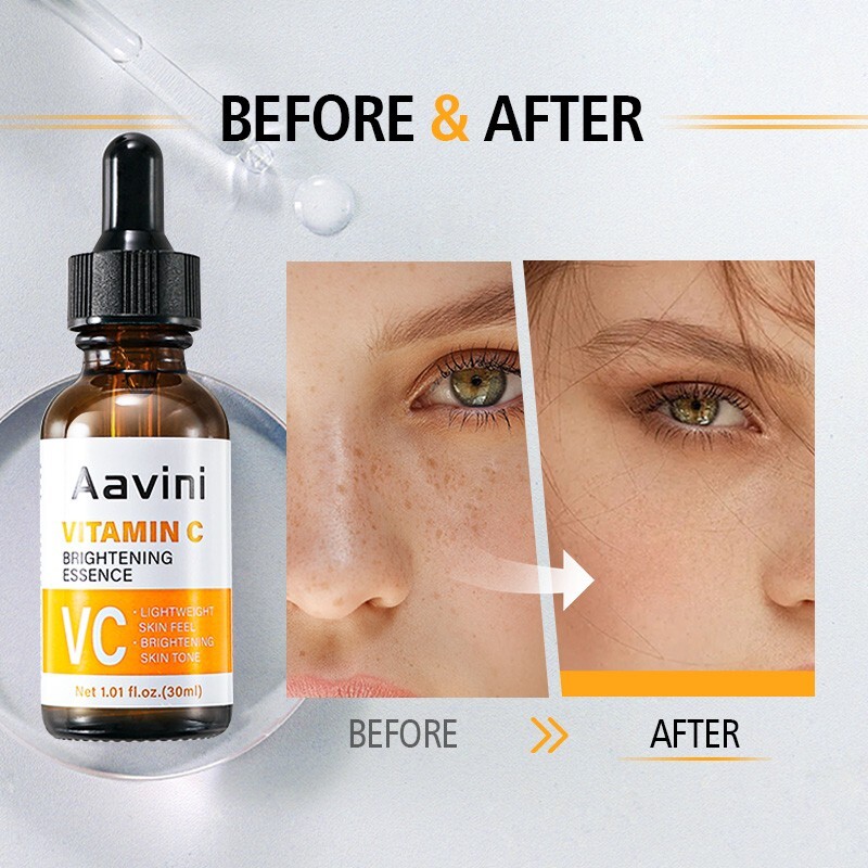 Whitening Face Serum Set Dark Spot Remover Retinol Vitamin C Firming Skin Care
