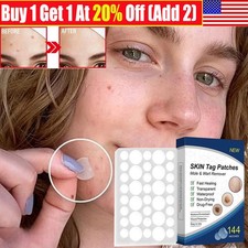 1-5boxs Skin Tag Remover Patche Quick Effective Mole and Wart Pad RemovalSticker