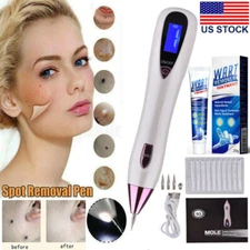 Warts Skin Tag Remover Cream / Laser Plasma Pen Moles Tattoo Removal Machine