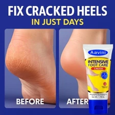Aavini Foot Cream 50g – Cracked Heel Repair, Intense Moisture & 24H Odor Protect