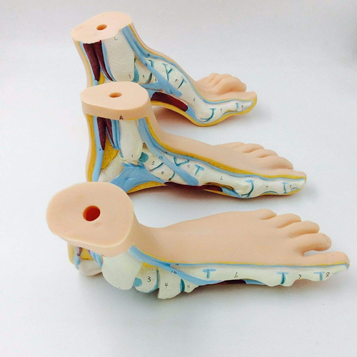 Kit of 3 pcs Normal Flat & Arched Foot Models anatomical model training - Picture 4 of 4
