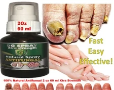 ANTI FUNGAL support EXTRA STRENGTH TOENAIL FUNGUS FUNGI XS NAIL ATHLETE'S FOOT