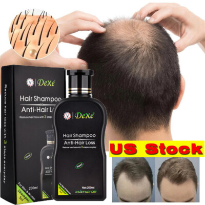 Dexe Anti Hair Loss Shampoo Natural Herbal Hair Growth Treatment Hair Regrowth