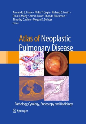 Atlas of Neoplastic Pulmonary Disease: Pathology, Cytology, Endoscopy and Radiol