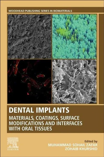 Dental Implants | Muhammad Zafar (U. A.) | Taschenbuch | Englisch | 2020-image