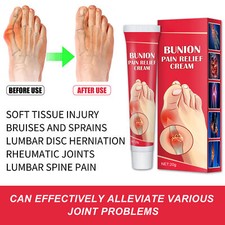 3x 0.7oz Bunion Relief Cream Herbal Extract Toe Swelling Relief Cream HOT