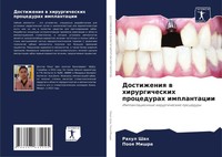 Rahul Shah (U. A.) | Dostizheniq W Hirurgicheskih Procedurah Implantacii | Buch