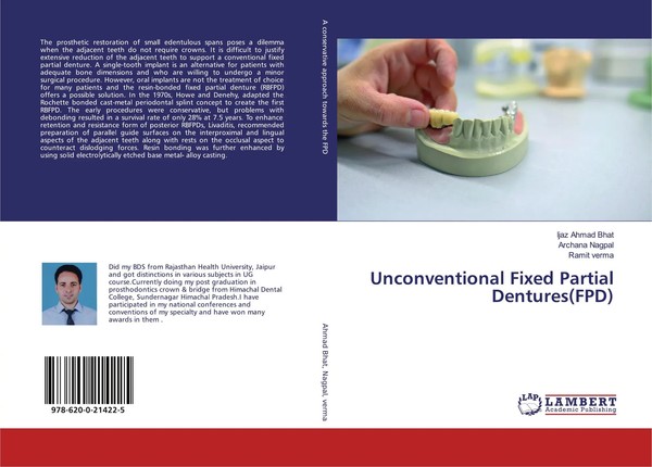 Ijaz Ahmad Bhat (U. A.) | Unconventional Fixed Partial Dentures(Fpd) | Buch-image
