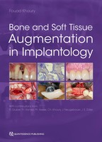 Bone And Soft Tissue Augmentation in Implantology Buch 768 S. Englisch 2021