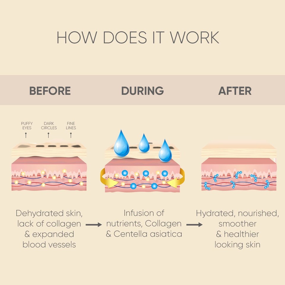 Celor Under Eye Patches for Puffy Eyes and Dark Circles Eye Masks