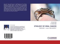 Etiology Of Oral Cancer Arun Singh