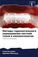 Gada Buslama (U. A.) | Metody Gorizontal'nogo Naraschiwaniq Kostnoj Tkani W...