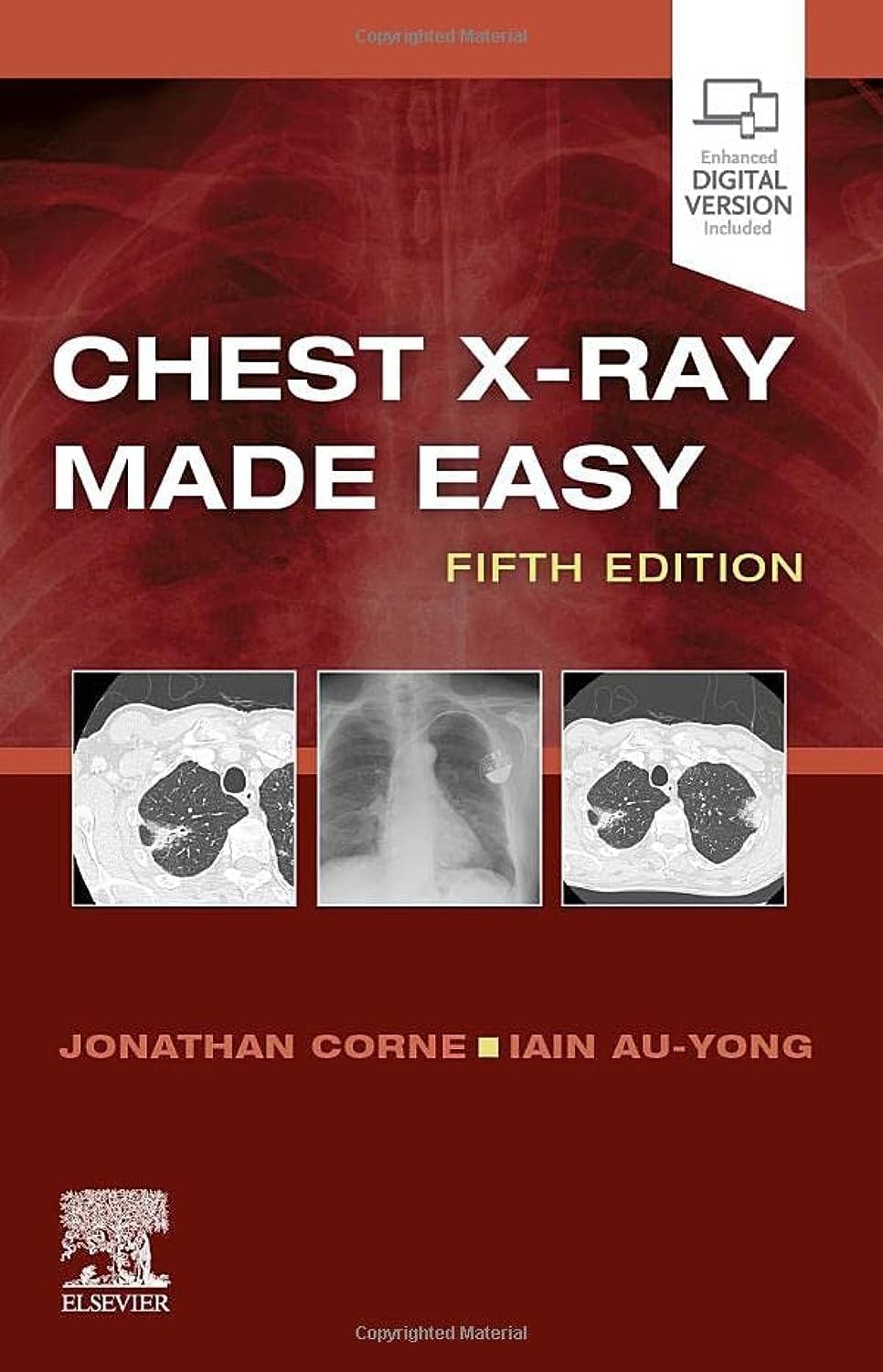 Chest X-Ray Made Easy Corne Au-Yong Paperback 9780702082344 5e - Image 3
